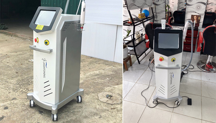 Máy Laser Toning 2020 thực tế