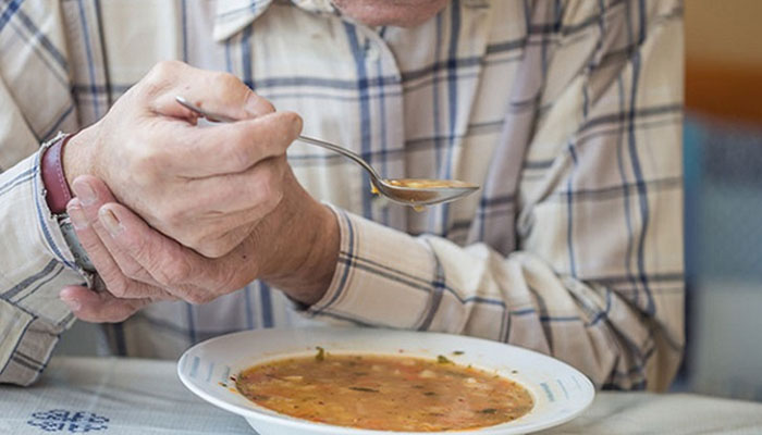 bệnh parkinson giai đoạn cuối là như thế nào